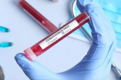 Two new Corona cases, number seven in Saudi Arabia